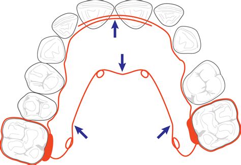 helix activation.